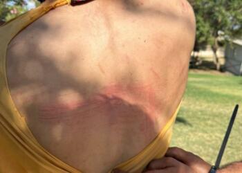 DEDAŞ’ı protesto eden çiftçiler karakolda da darp edildi