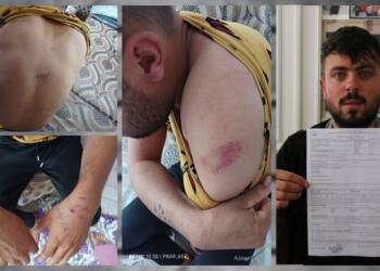 Başına çuval geçirilip kaçırıldı: 11 saat elektrikli işkence gördü