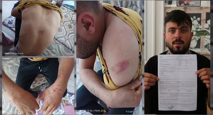 Başına çuval geçirilip kaçırıldı: 11 saat elektrikli işkence gördü