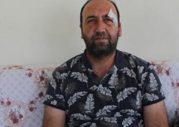 Gazeteciye belediye başkanının koruması saldırdı