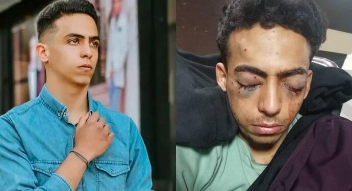 İran’da protestocu yaralı genç tutuklandı