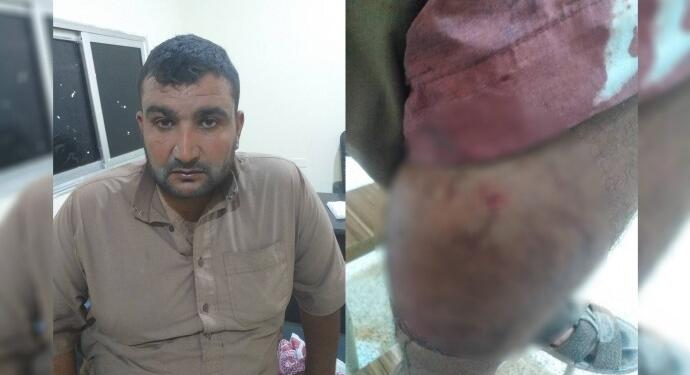 SİHA saldırısında bir kişi yaralandı