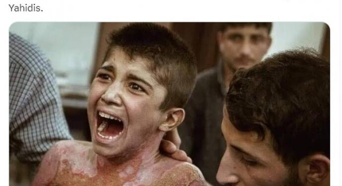 Türkiye’nin yaraladığı çocuğu ‘İsrail yaptı’ diye paylaştı!