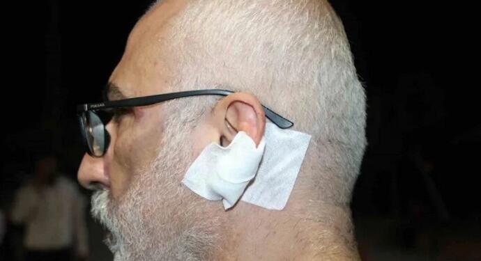 DFG, üyeleri Fuat Bulut’a saldırıyı kınadı