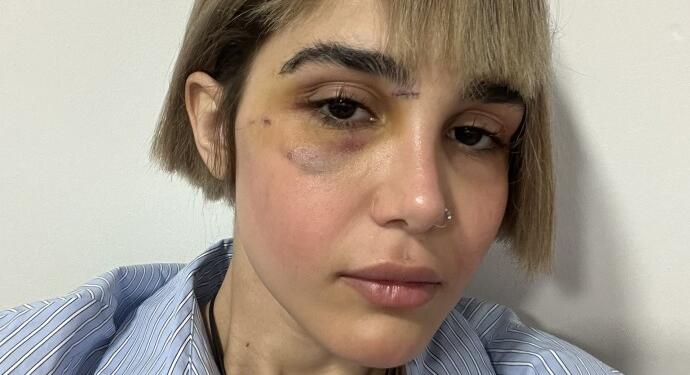 İranlı gazeteci Maroofian: Süleymaniye’de işkence gördüm