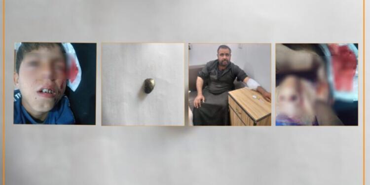 Türkiye’nin Minbic’e saldırısı sonucu biri çocuk iki sivil yaralandı