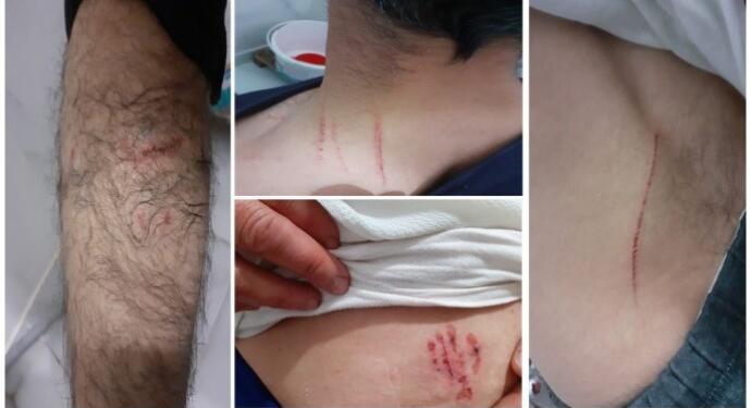 Köpekle işkence davasında savcı mütealaayı değiştirdi, ‘beraat’ istedi