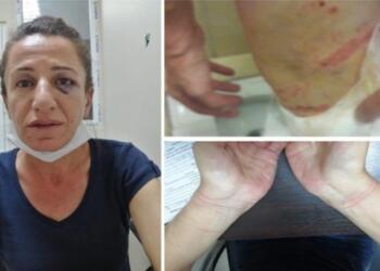 ‘Köpekli işkence’de sicili kabarık polise beraat: Köpek tahrik edildi