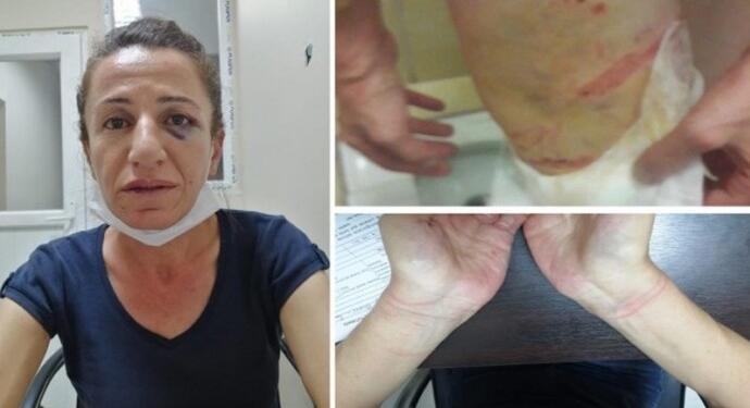 ‘Köpekli işkence’de sicili kabarık polise beraat: Köpek tahrik edildi