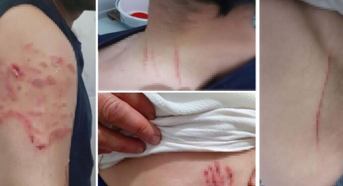 Köpekli işkencede polis sorumlu tutulamaz kararı
