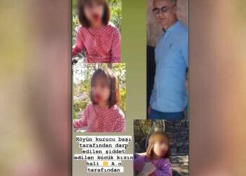 Korucubaşı 10 yaşındaki çocuğun dişlerini kırdı