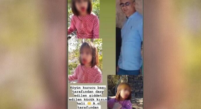 Korucubaşı 10 yaşındaki çocuğun dişlerini kırdı