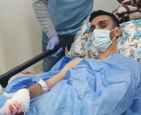 Parmağı koptu 10 saat sonra ameliyata alındı