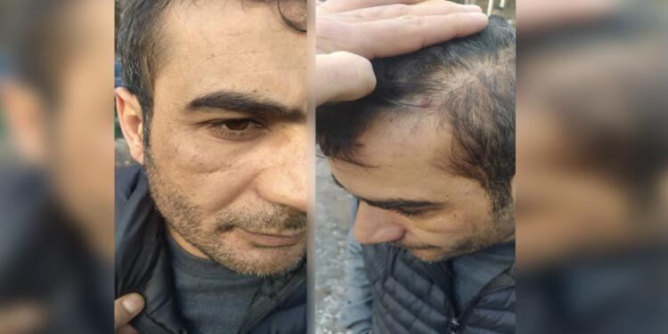 ‘Kürt müsün’ diye soran ırkçı grubun saldırısına uğradı