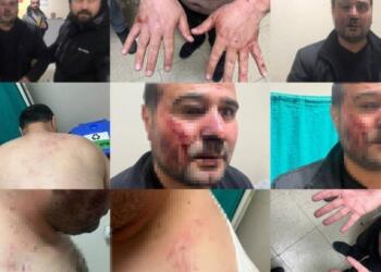 Gözaltında polis tarafından darp edilen Kaval serbest bırakıldı