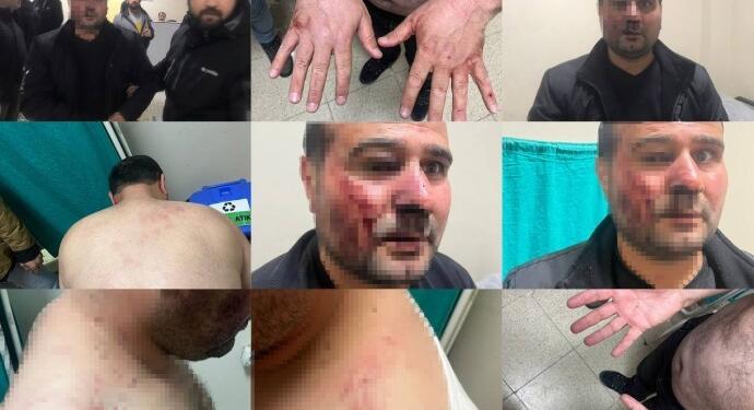 Colemêrg’teki polis şiddeti Meclis gündemine taşındı