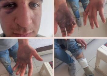 Asker ve korucuların penseli işkencesini savcı görmedi