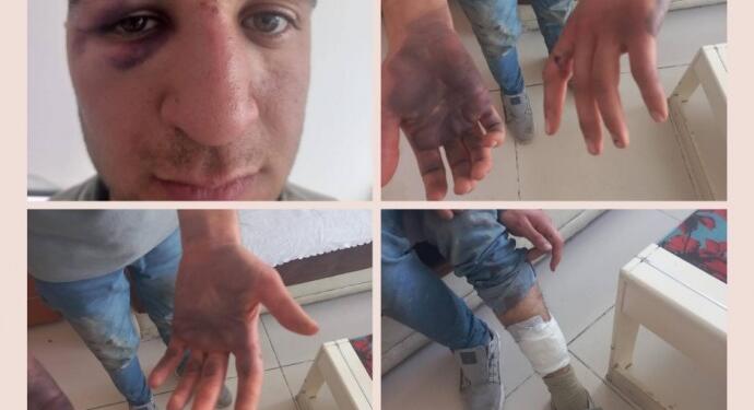 Asker ve korucuların penseli işkencesini savcı görmedi