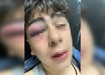 Newroz’da çocuğa işkence yapan polislerin davası yarın