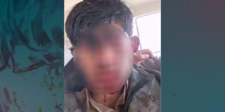 İran güçlerinin saldırısında bir kolber ağır yaralandı