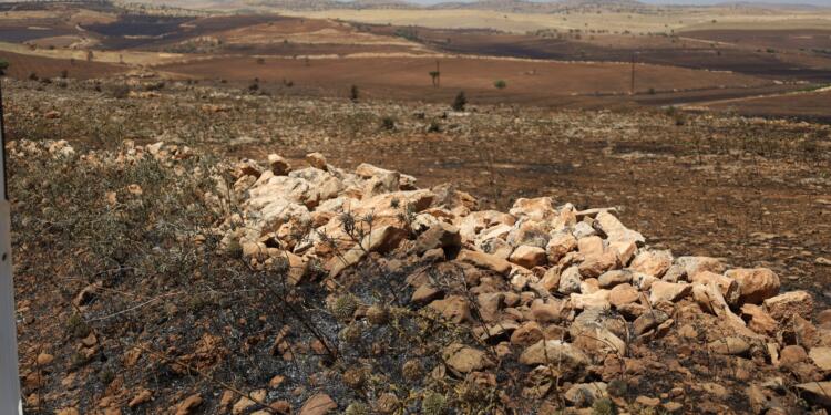 Mêrdîn Tabip Odası: Yanık ünitesi olmadığı için ölümler arttı