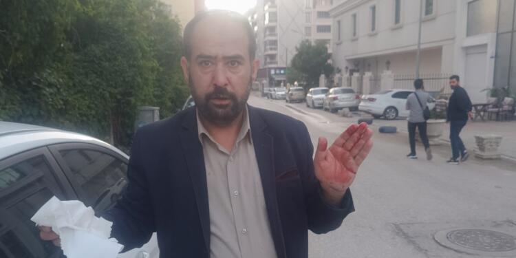 Gazeteci İpek darp edildi