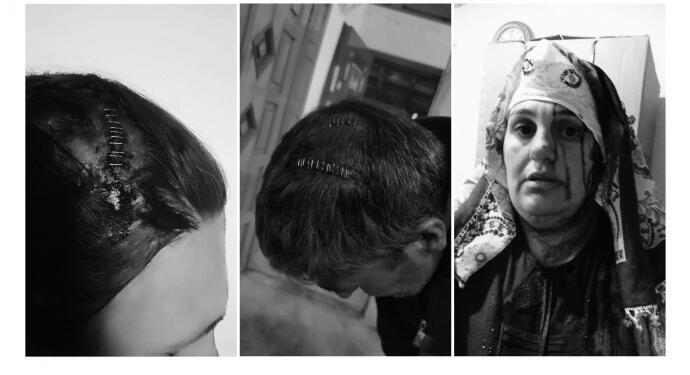 Tacize uğrayan kadın destek istedi