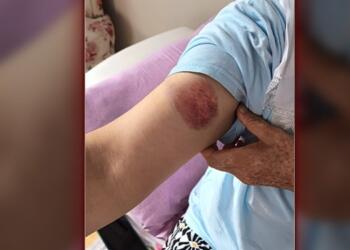 Tutsak yakını Fince Akman’a polis şiddeti