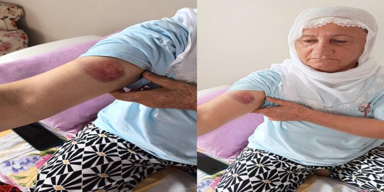 Gözaltında darp edilen Akman: İrademizi kıramazlar