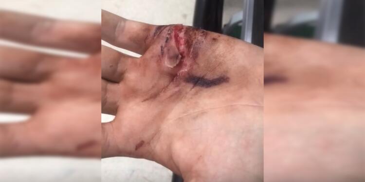 Gözaltında işkence: Elleri yarıldı