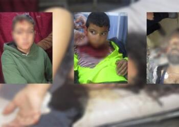 Efrîn-Şehba’ya saldırıda yine çocuklar yaralandı!