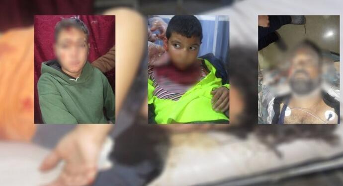 Efrîn-Şehba’ya saldırıda yine çocuklar yaralandı!