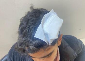 Bekçilerden Kürt aileye saldırı: Elektroşok kullandılar