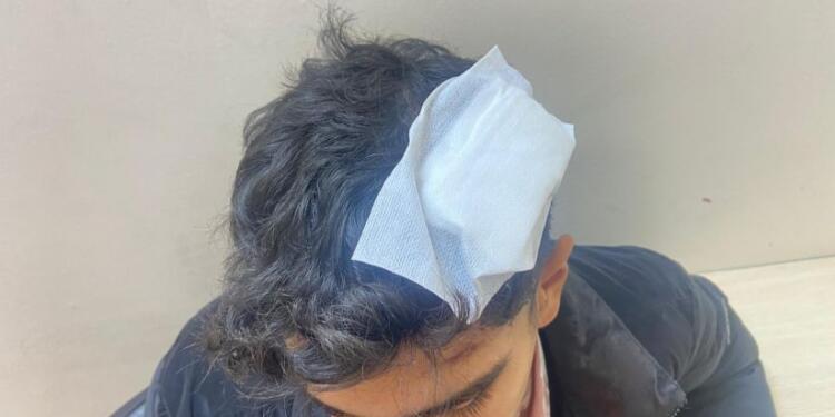 Bekçilerden Kürt aileye saldırı: Elektroşok kullandılar