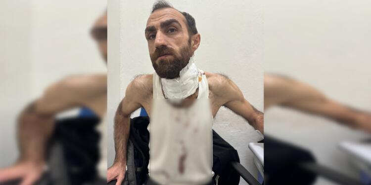 Ev baskınında engelli yurttaşa köpekli işkence