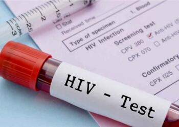 Çocuklarda HIV pozitif vakalarında artış var