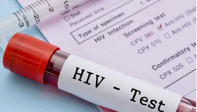 Çocuklarda HIV pozitif vakalarında artış var