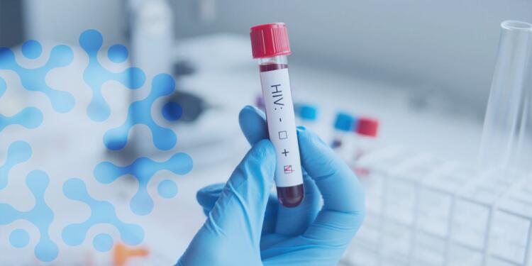 HIV vakaları artıyor: Toplumsal bilinç oluşturulmalı