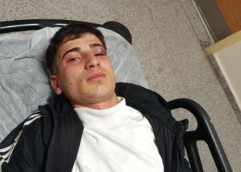 Polis ve bekçiler 2 kişiyi darp ederek gözaltına aldı