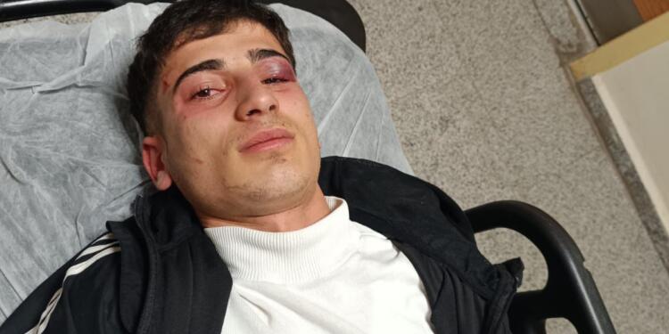 Polis ve bekçiler 2 kişiyi darp ederek gözaltına aldı