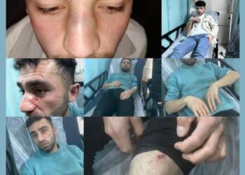 Colemêrg’te polis şiddeti: Darp raporu alan gençler gözaltında