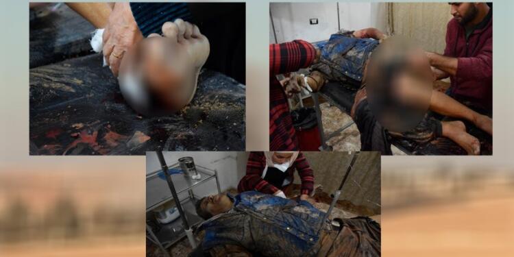 Saldırıların 3 günlük bilançosu: 31 sivil katledildi