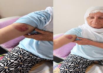 ‘Özgürlük’ mitinginde şiddet uygulayan polislere suç duyurusu