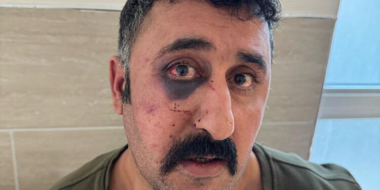 Yurttaşa işkence yapan polis, avukatı da darp etti