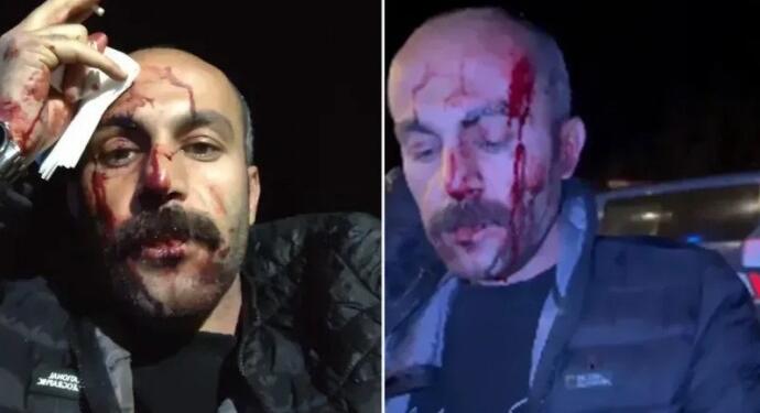 TBB’den polis şiddetine tepki