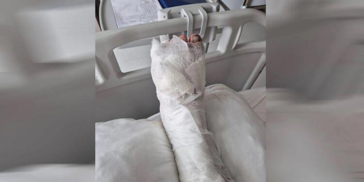 TOMA’nın ayağını ezdiği genç 2 ay yürüyemeyecek