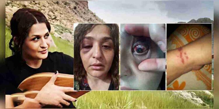 İranlı yazar Mehrgan Nemawer işkenceye uğradı