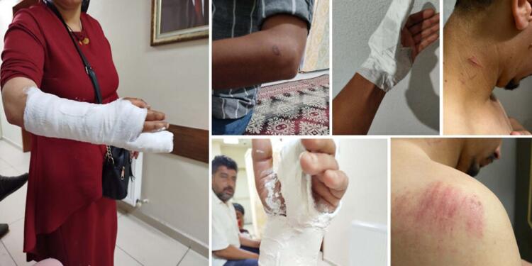 Sakarya’da polis bir aileye yol ortasında işkence yaptı