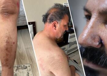 Ev baskınında polisler tarafından darp edildiler, ölüm tehditti aldılar