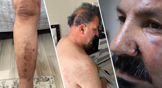 Ev baskınında polisler tarafından darp edildiler, ölüm tehditti aldılar